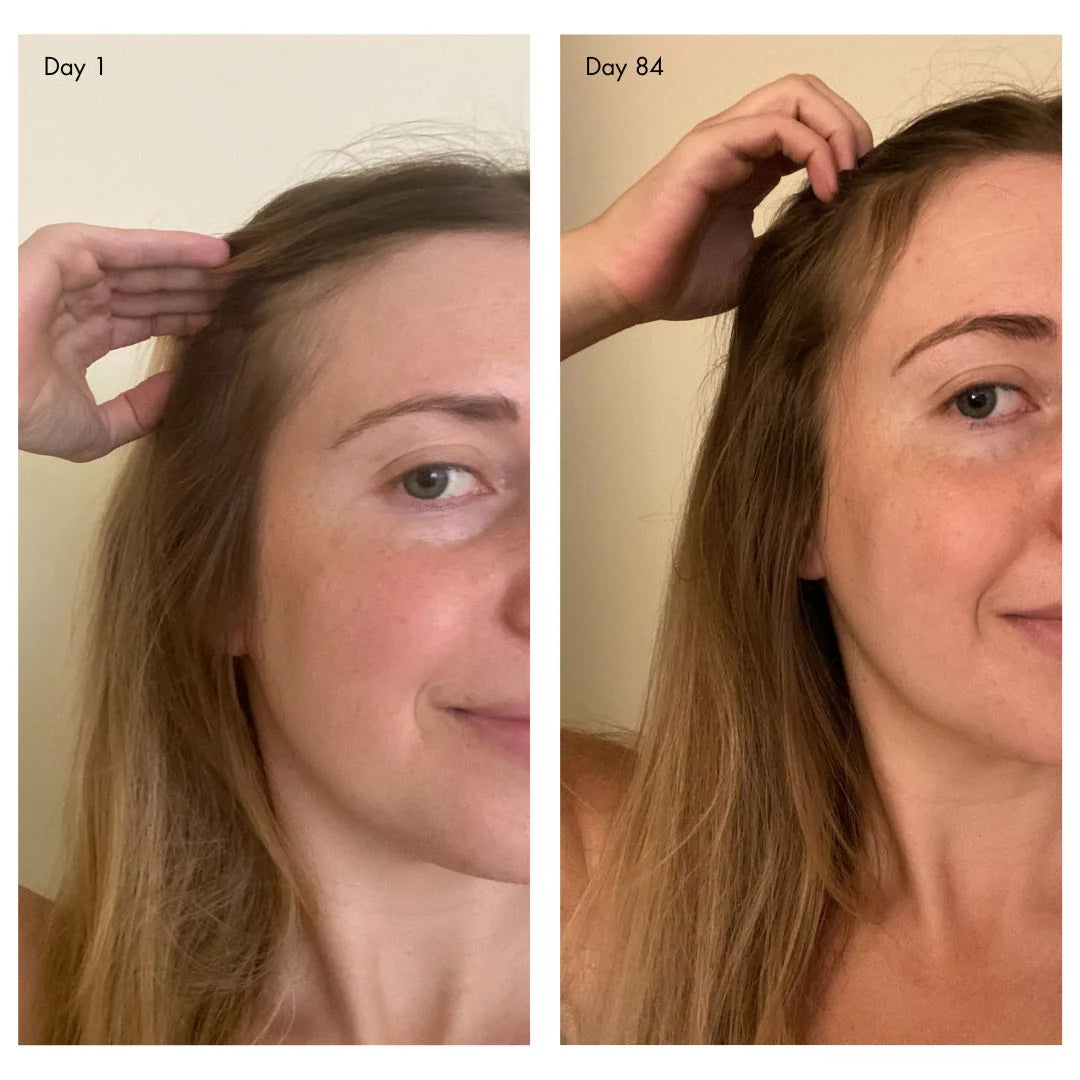 Agent Nateur | holi (growth) 84 leave-in hair growth scalp spray