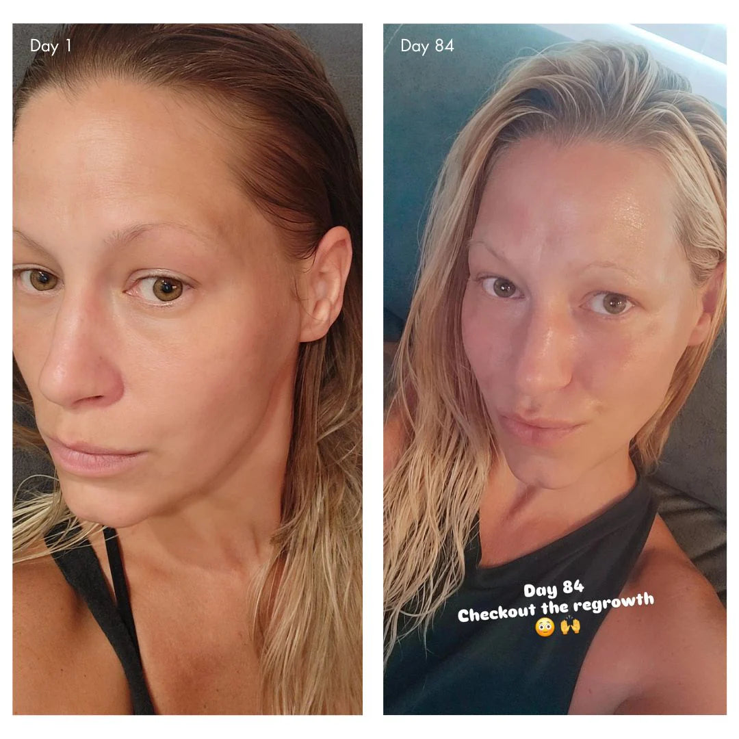 Agent Nateur | holi (growth) 84 leave-in hair growth scalp spray