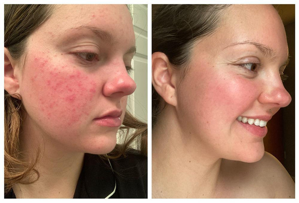 Blissoma Restore - Omega Miracle Facial Oil