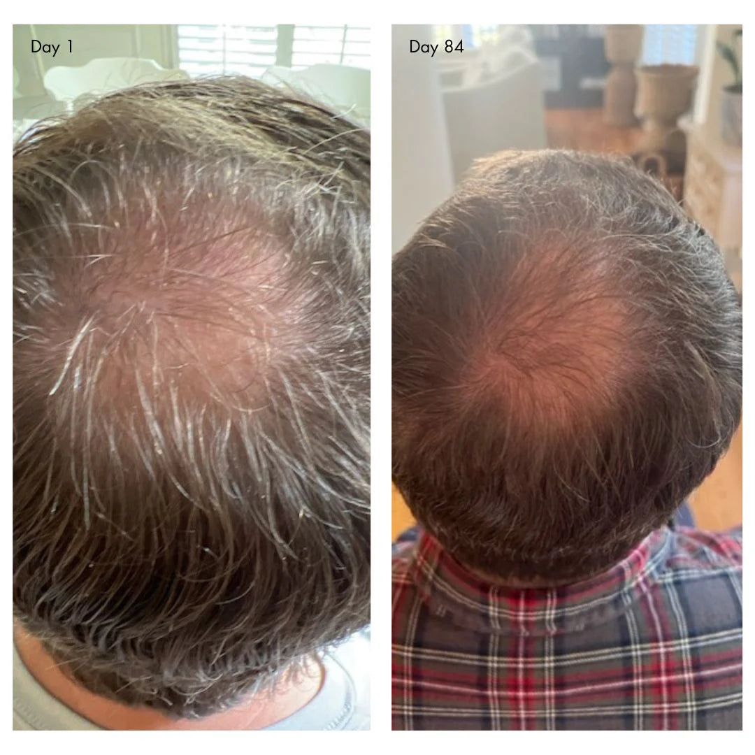 Agent Nateur | holi (growth) 84 leave-in hair growth scalp spray