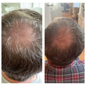 Agent Nateur | holi (growth) 84 leave-in hair growth scalp spray