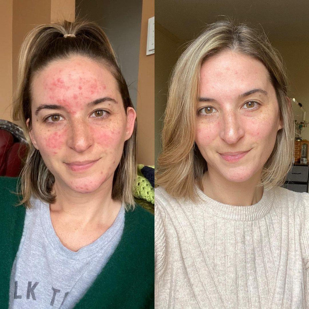 Blissoma Peace -Evening Calming Elixir