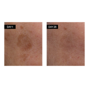 Odacité Skincare | Brightening Serum Vitamin C &amp; E + Hyaluronic Acid Results