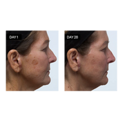 Odacité Skincare | Brightening Serum Vitamin C &amp; E + Hyaluronic Acid Results