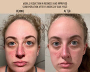 MILK + TANSY | Bi-Phase Essence (Free Sample)