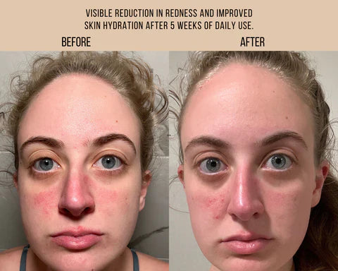 MILK + TANSY | Bi-Phase Essence (Free Sample)