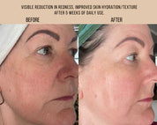 MILK + TANSY | Bi-Phase Essence (Free Sample)