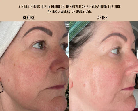 MILK + TANSY | Bi-Phase Essence (Free Sample)