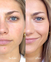 Ere Perez | Arnica All-Cover Pot