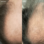 MAYA CHIA | THE POWER FOL SCALP & HAIR | advanced multi-correctional treatment