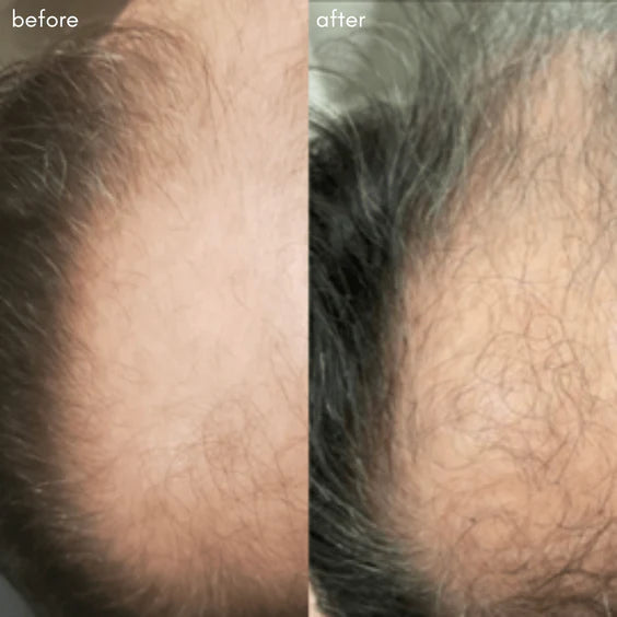 MAYA CHIA | THE POWER FOL SCALP & HAIR | advanced multi-correctional treatment