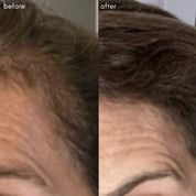 MAYA CHIA | THE POWER FOL SCALP & HAIR | advanced multi-correctional treatment