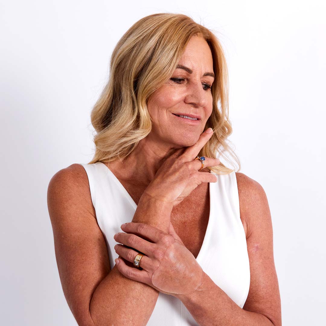 Wrinkles Schminkles | Hand Wrinkle Patches