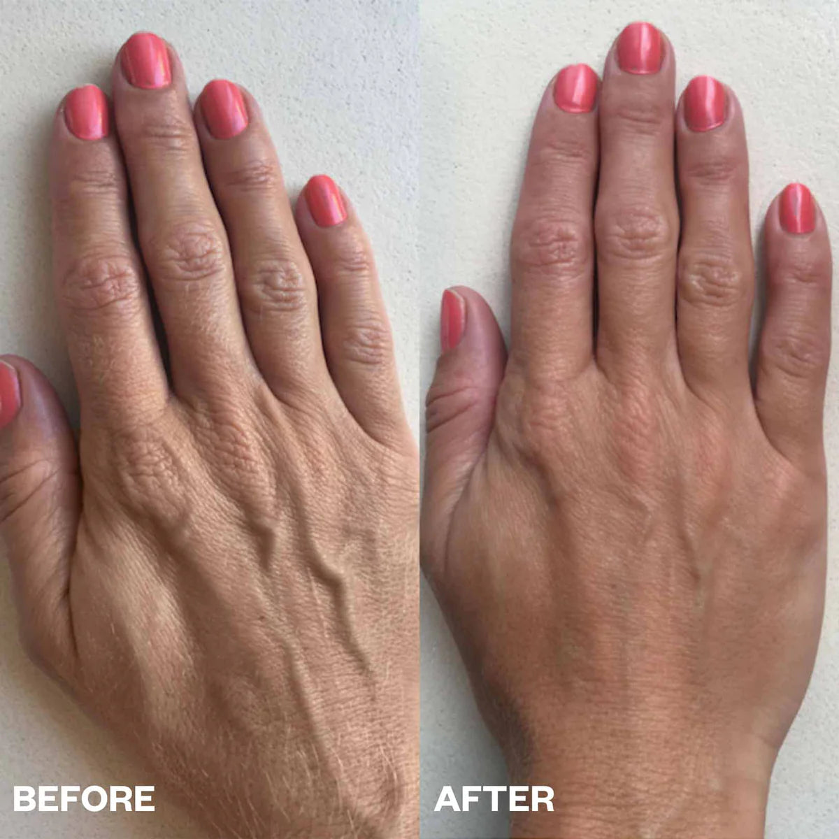 Wrinkles Schminkles | Hand Wrinkle Patches Results