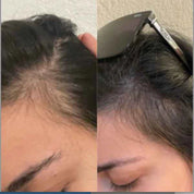 MAYA CHIA | THE POWER FOL SCALP & HAIR | advanced multi-correctional treatment