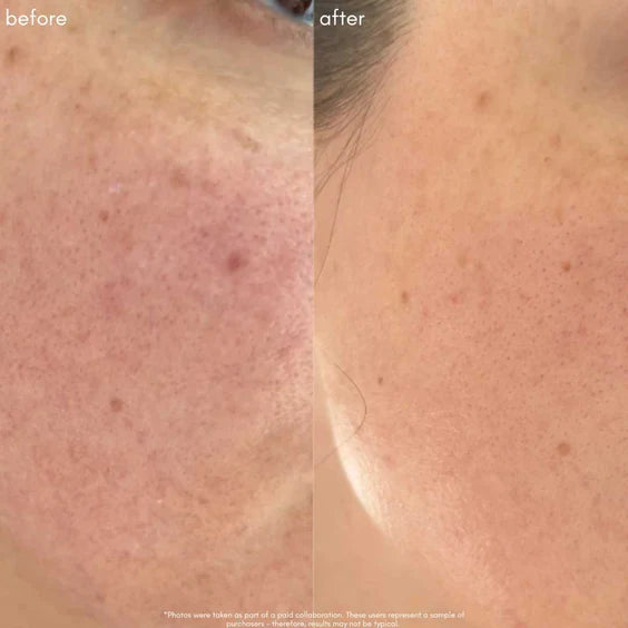 Maya Chia The Straight A Serum Advanced Gentle Retinol Srum Results