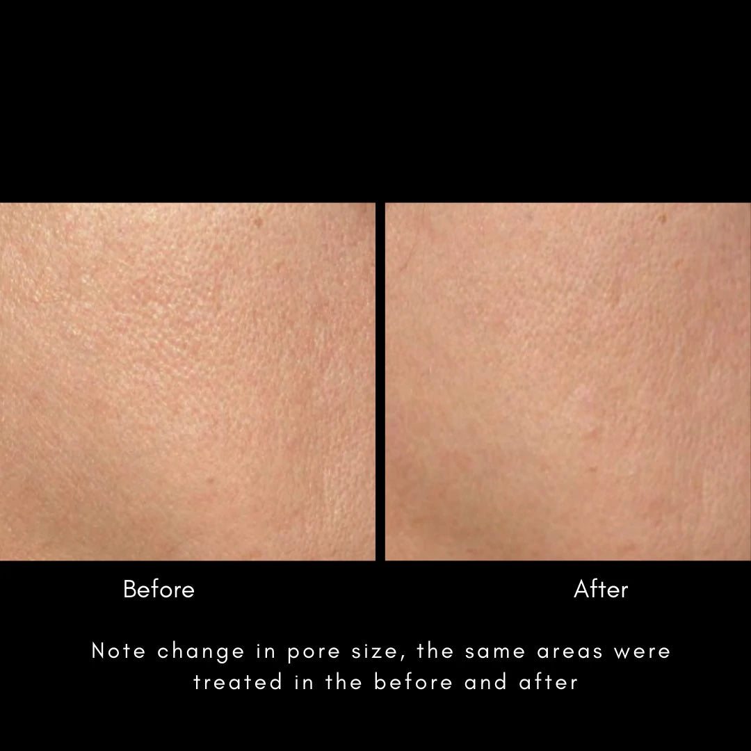 Maya Chia | THE ADVANCED RESPONSE COMPLEX – Rapid Regenerating, Firming Face & Neck Cream