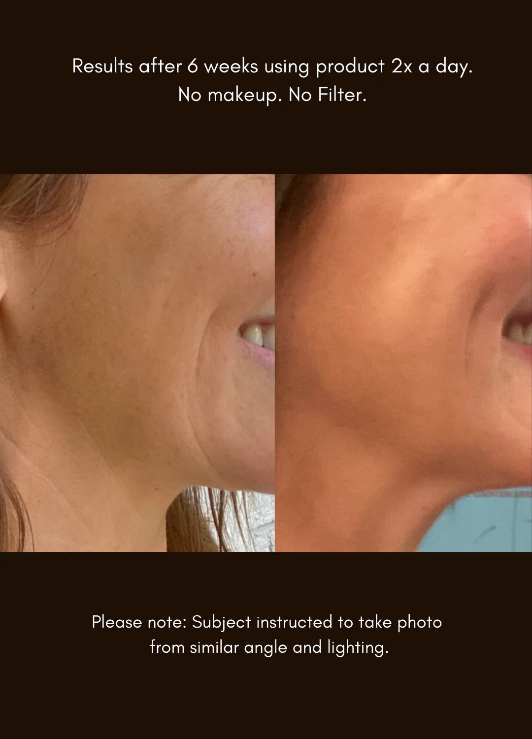 Maya Chia | THE ADVANCED RESPONSE COMPLEX – Rapid Regenerating, Firming Face & Neck Cream