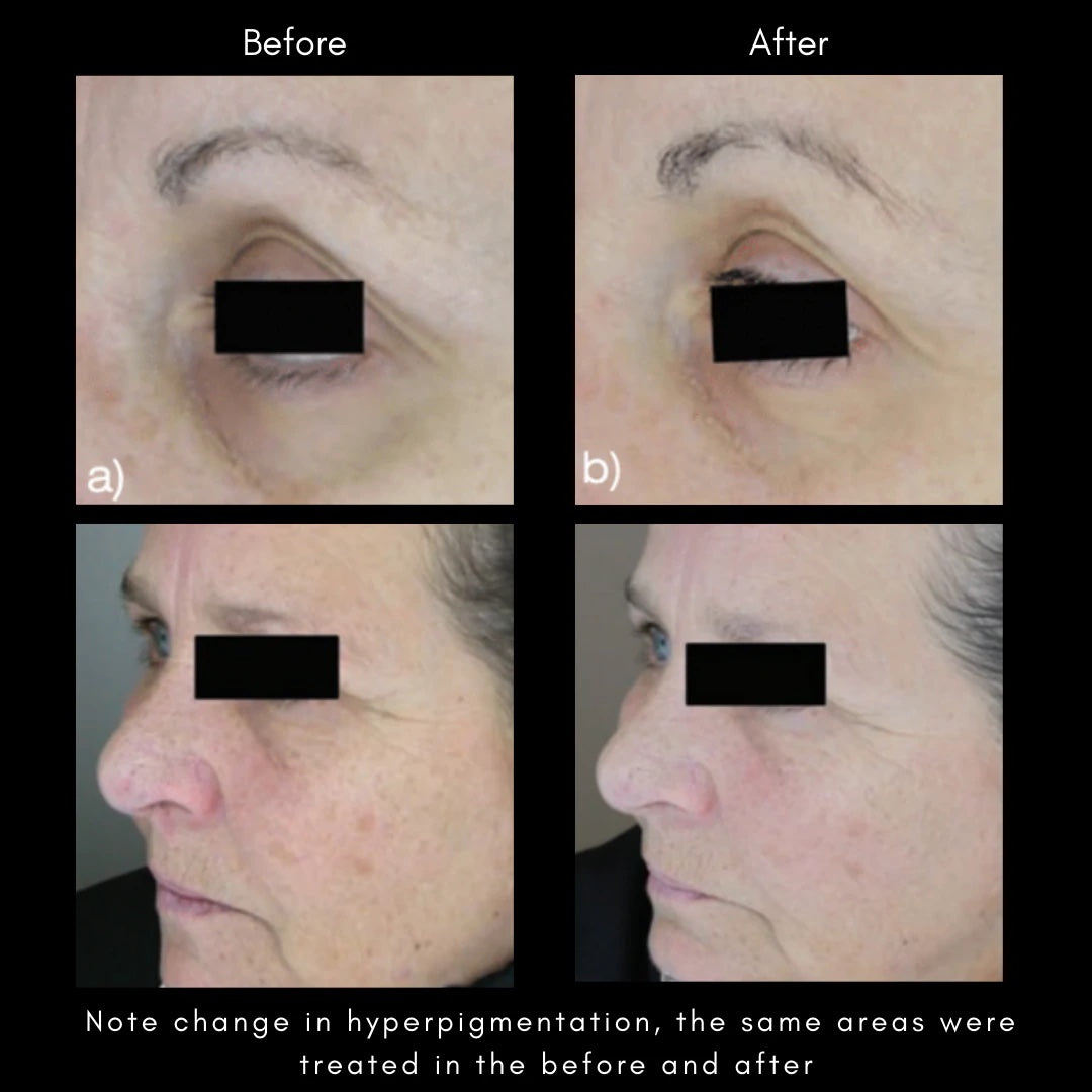 Maya Chia | THE ADVANCED RESPONSE COMPLEX – Rapid Regenerating, Firming Face & Neck Cream