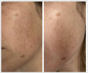 Free + True Skincare | BRIGHT SIDE Vitamin C Serum