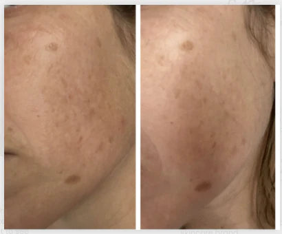 Free + True Skincare | BRIGHT SIDE Vitamin C Serum