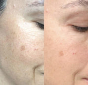 Maya Chia The Straight A Serum Advanced Gentle Retinol Srum Results