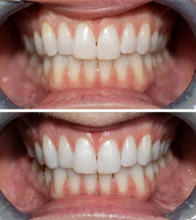 Terra & Co. | Brilliant Black ToothpasteTerra & Co. | Brilliant Black Oil Pulling