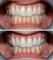 Terra & Co. | Brilliant Black Toothpaste