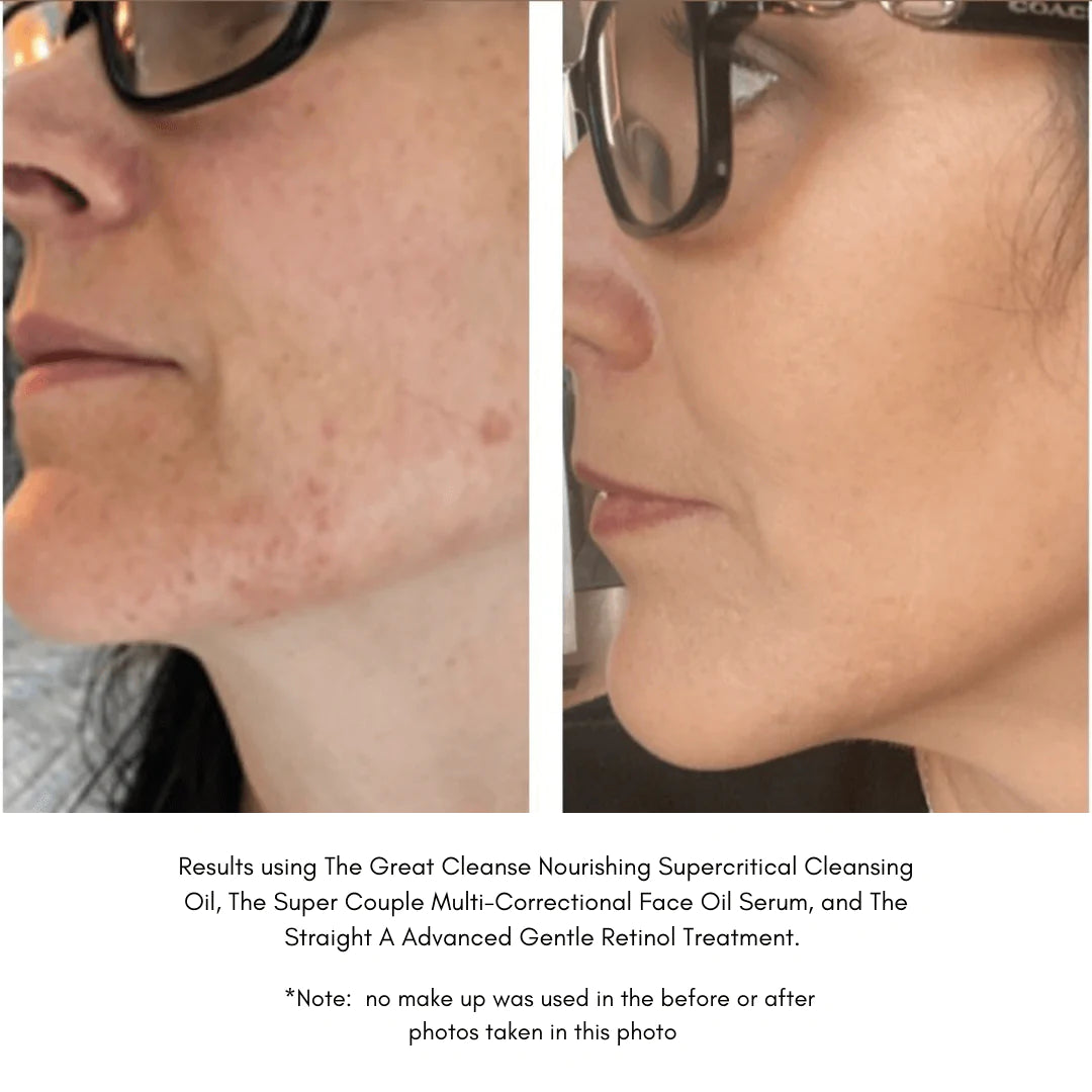 Maya Chia | THE GREAT CLEANSE – Nourishing Supercritical Cleansing Oil