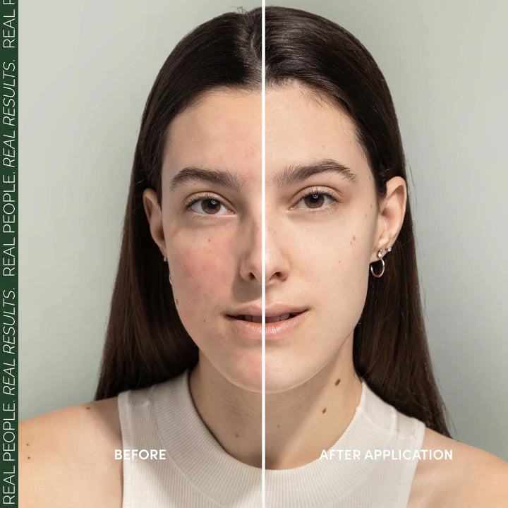 Fitglow Beauty | REDNESS RESCUE CREAM