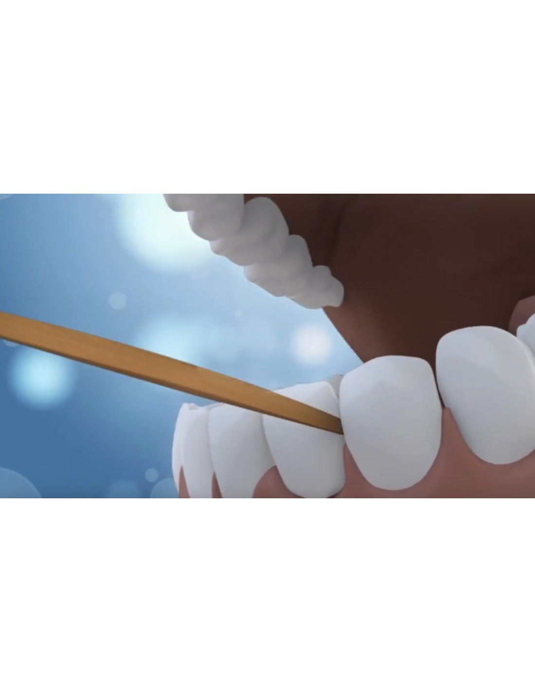 Perio Sticks Thin - 100 Sticks